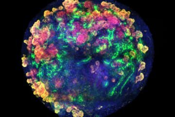 El primer trasplante de minirriñones humanos en cerdos abre una vía para no desperdiciar miles de órganos donados