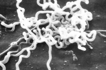 La bacteria causante de la sífilis ya estaba en América hace 5.500 años