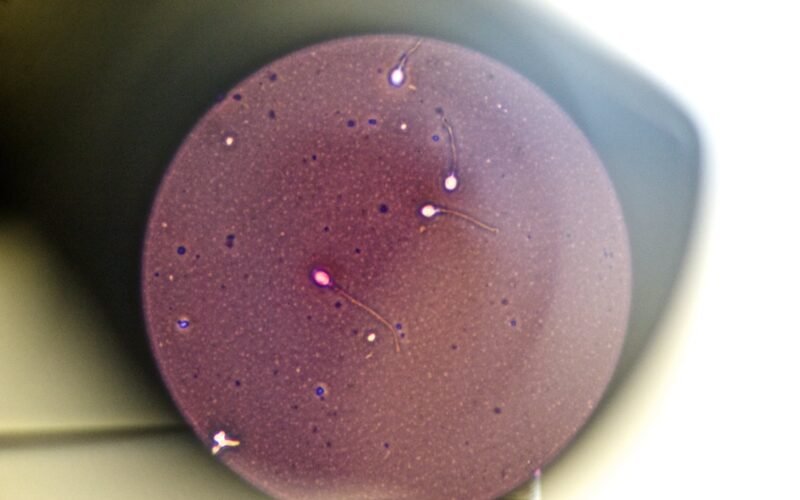 Eyacular con frecuencia mejora la calidad del esperma, según el mayor estudio hasta la fecha