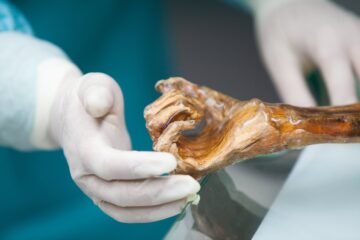 Los microbios de Ötzi, el hombre de los hielos, se despiertan miles de años después de su muerte