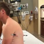 Un senderista con un bastón atravesado camina durante seis horas por miedo a la factura del rescate