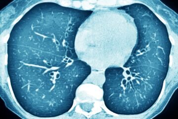 ARN de transferencia, un mismo tratamiento pionero para decenas de enfermedades genéticas
