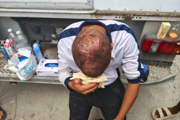 Decenas de migrantes denuncian agresiones de militares: “Nos dicen que si no nos vamos, seguirán las palizas”